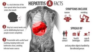 Hepatitis A Facts